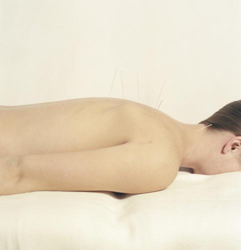 VIII Matinal d’Acupuntura del CFC, punt de trobada dels fisioterapeutes acupuntors